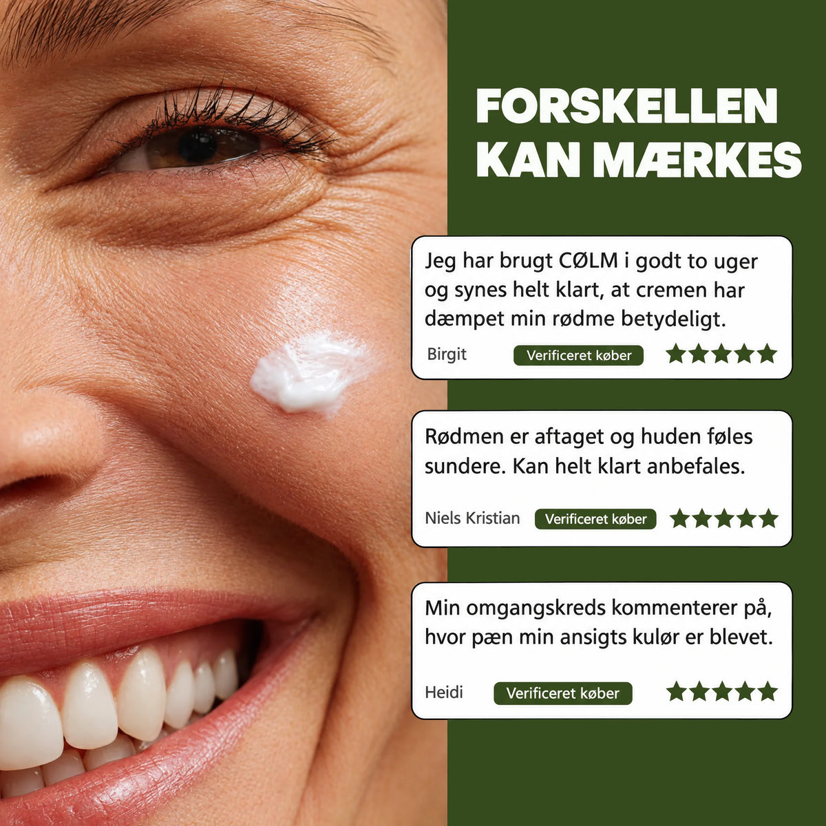 Smilende kvinde med en klat CØLM Redness Relieving Cream på kinden, ved siden af tre kundeanmeldelser med fem stjerner fra verificerede købere.