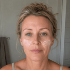CØLM Redness Relieving Cream fordelt i tyndt lag på kinderne mod rosacea hos kvinde